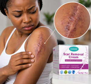 Scar-Care_-Close-Up-Treatment-Ad.png